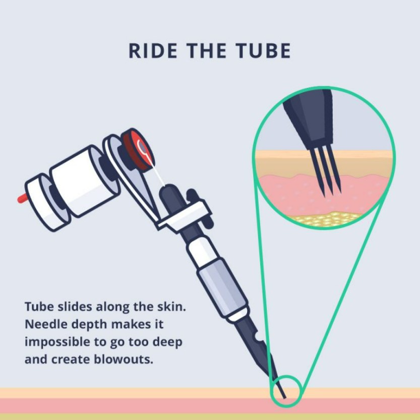 tattoo needle staying above the fat layer