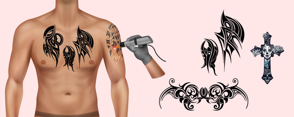 Man getting tattoo removal via lazer