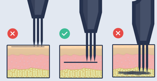 tattoo needle putting tattoo inks in different skin layers